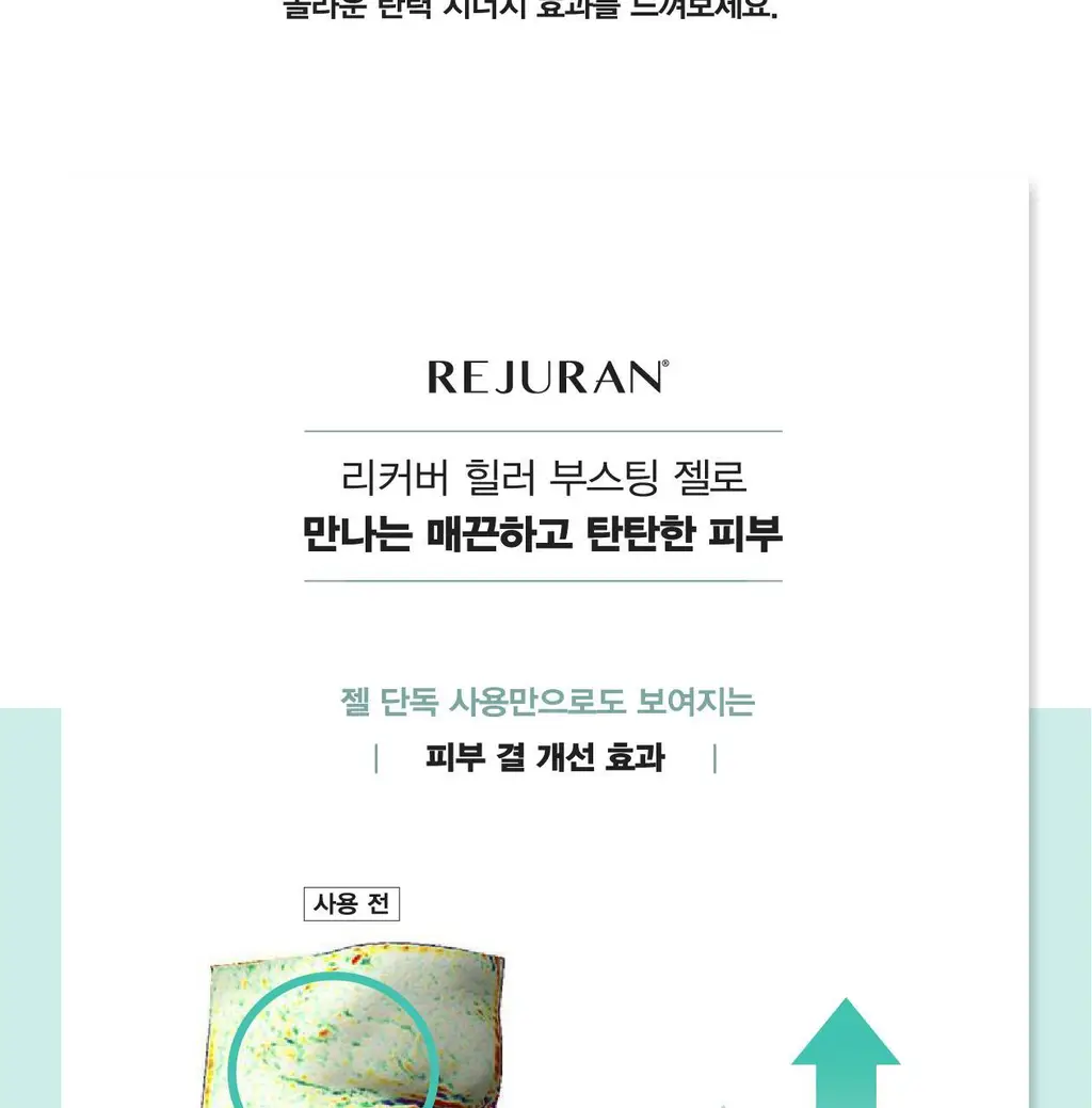 [오리지널 PDRN 부스팅]리쥬란 리커버 힐러 부스팅 젤 200ml 상세페이지 21